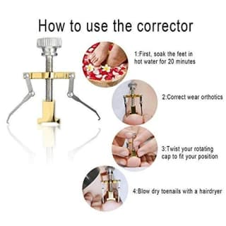 Ingrown Toenail Toe Fixer Recover Correction Device